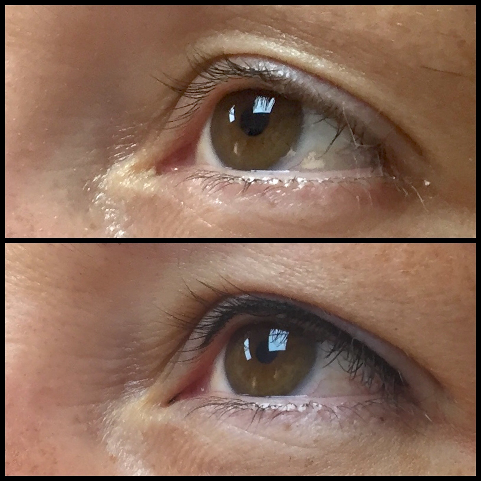Permanente eyeliner, resultaat van DFine Clinic (5) Permanente eyeliner, resultaat van DFine Clinic (5)