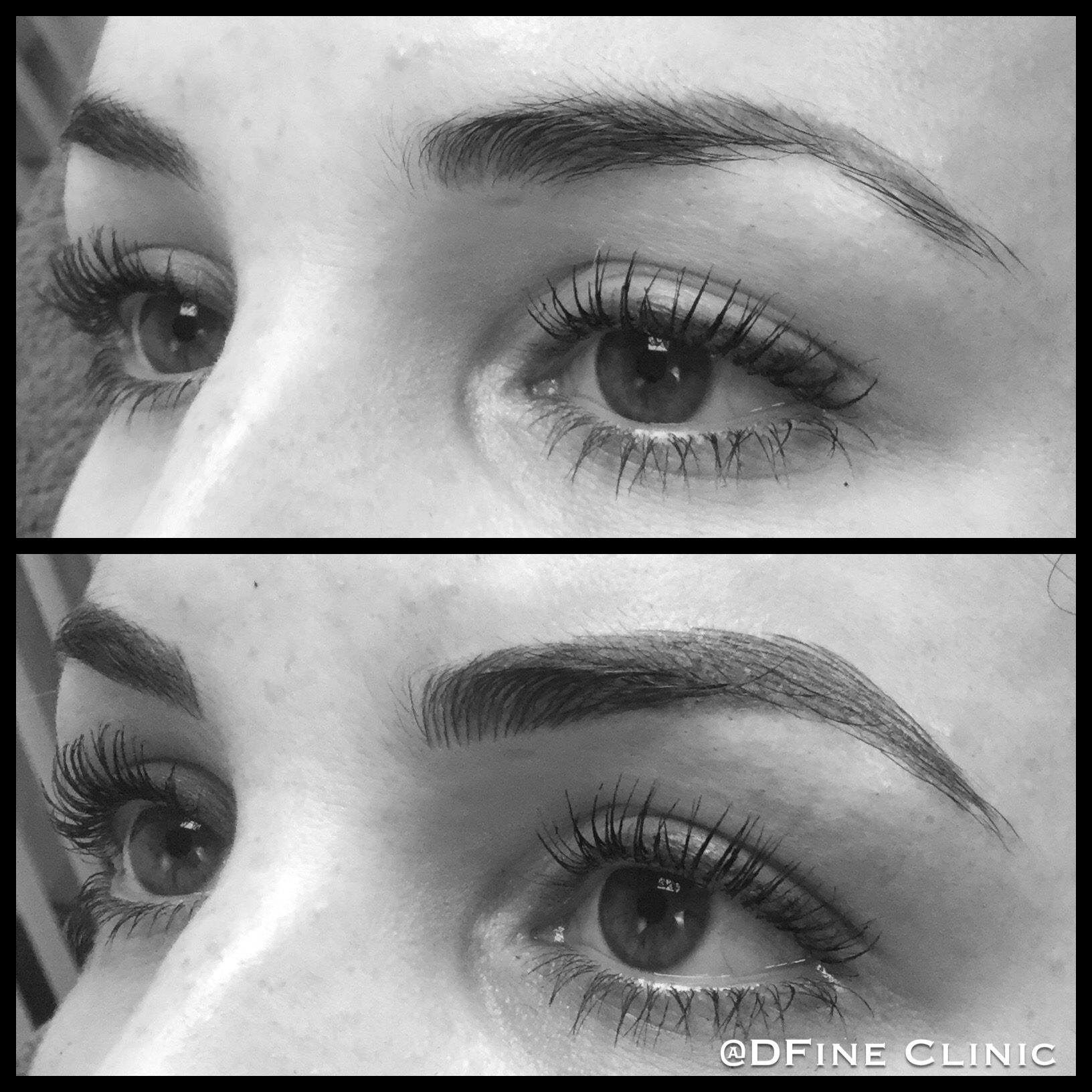 Permanente make-up wenkbrauwen bij een vrouw, resultaat van DFine Clinic (2) Permanente make-up wenkbrauwen bij een vrouw, resultaat van DFine Clinic (2)