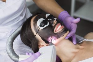 Black peel de acné behandeling CARBON BLACK LASER 2 DFine Clinic Black peel de acne behandeling CARBON BLACK LASER 2