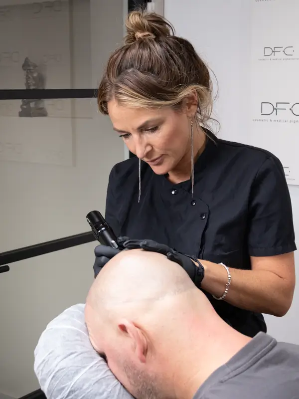 dfineclinic_micro-haar-pigmentatie_12